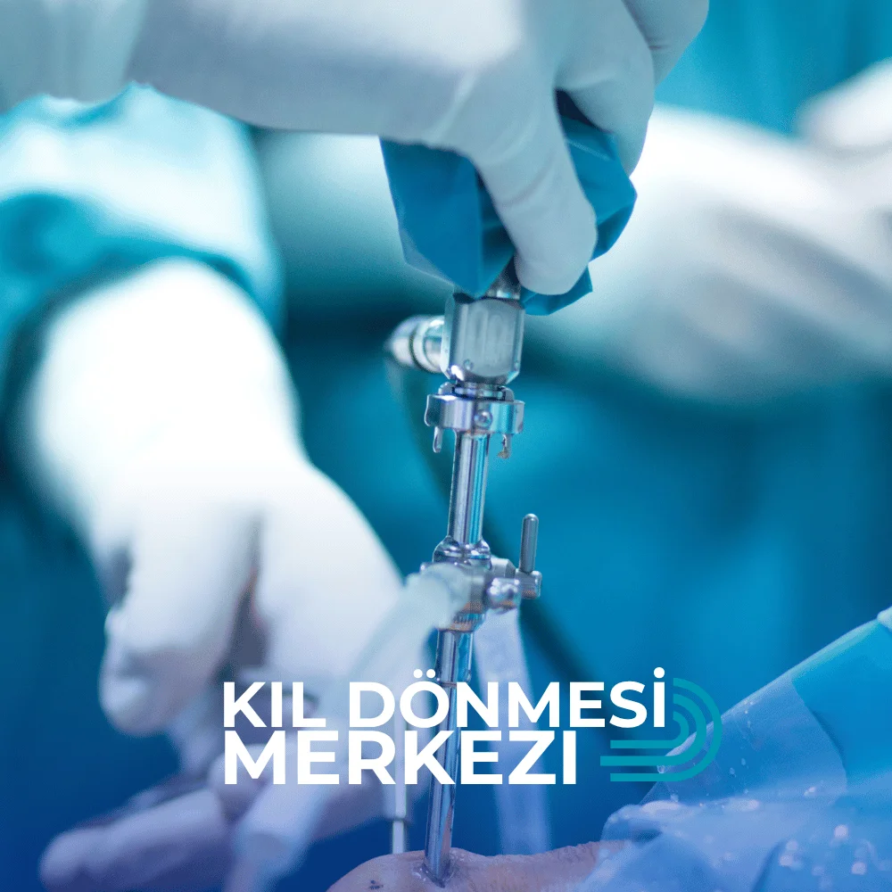 istanbul en iyi lazerli kıl dönmesi ameliyatı